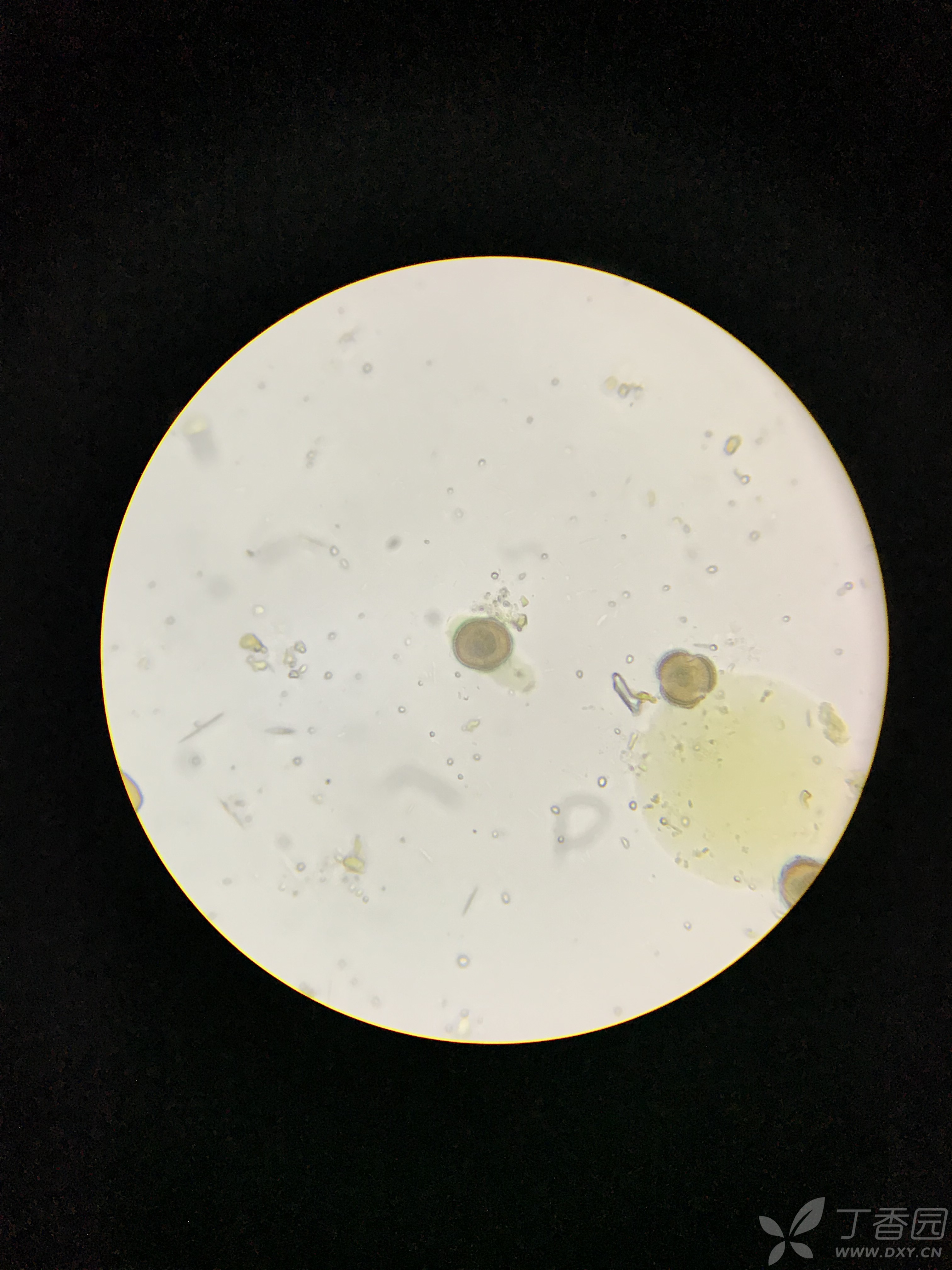 显微镜下的阴虱图片