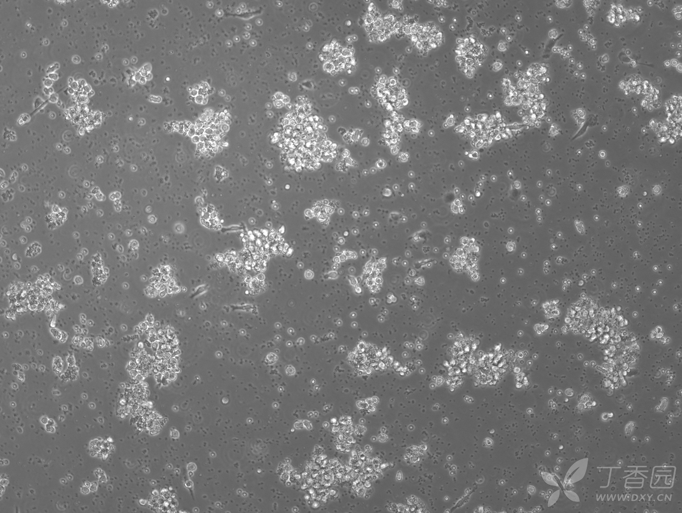 树突状细胞形态图片