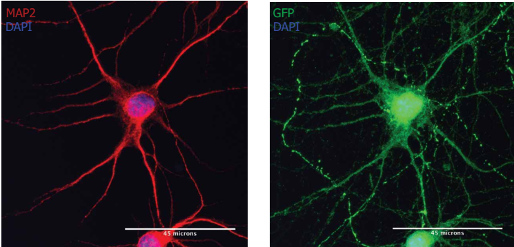 神经元光镜结构图红蓝图片