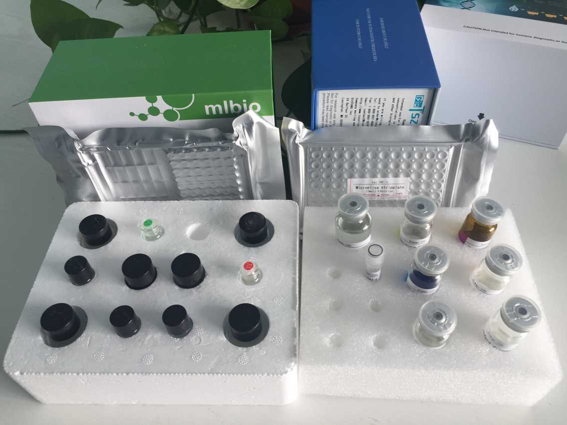 人抗OJ抗体(Anti-OJ)ELISA试剂盒