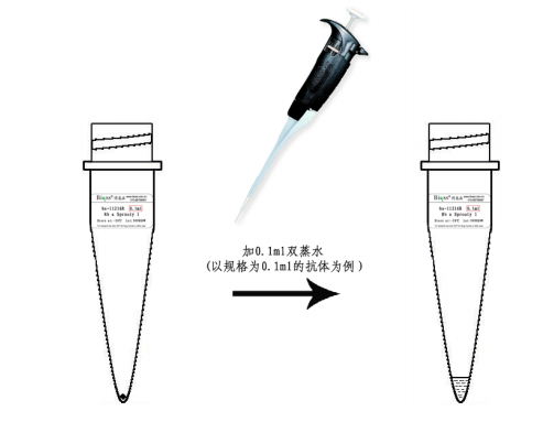 三磷酸腺柠檬酸裂解酶抗体