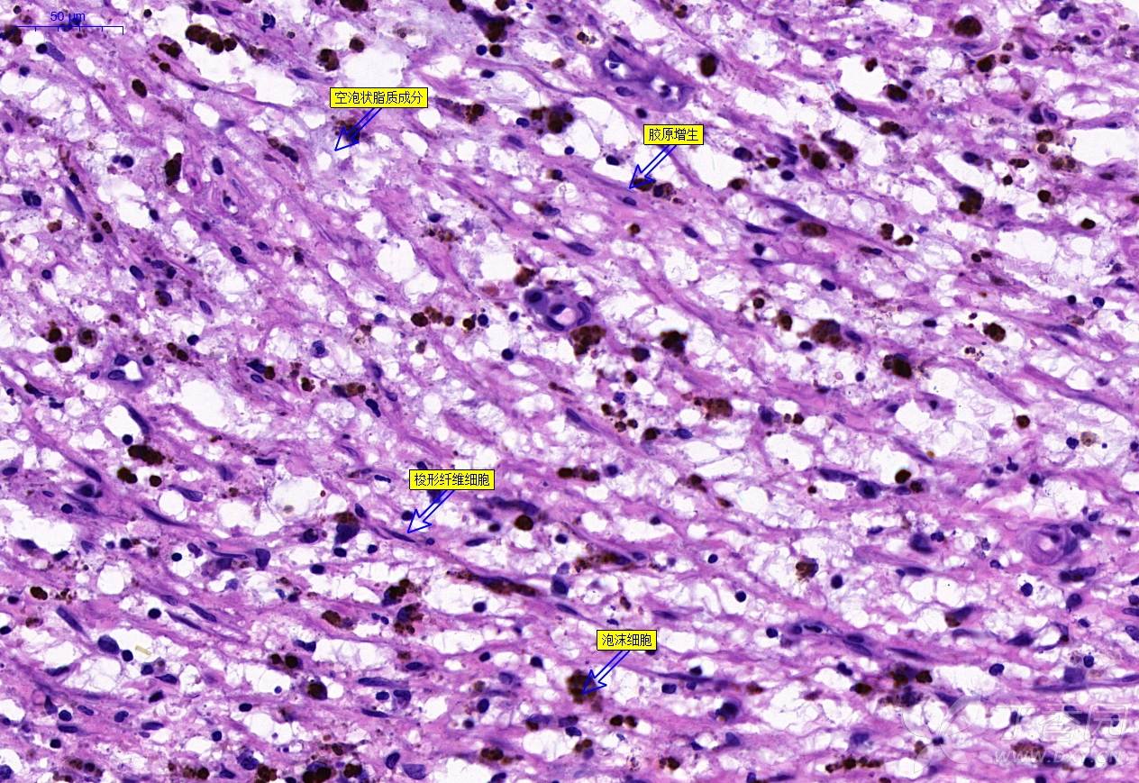 求助:人主动脉he染色切片 谢谢!