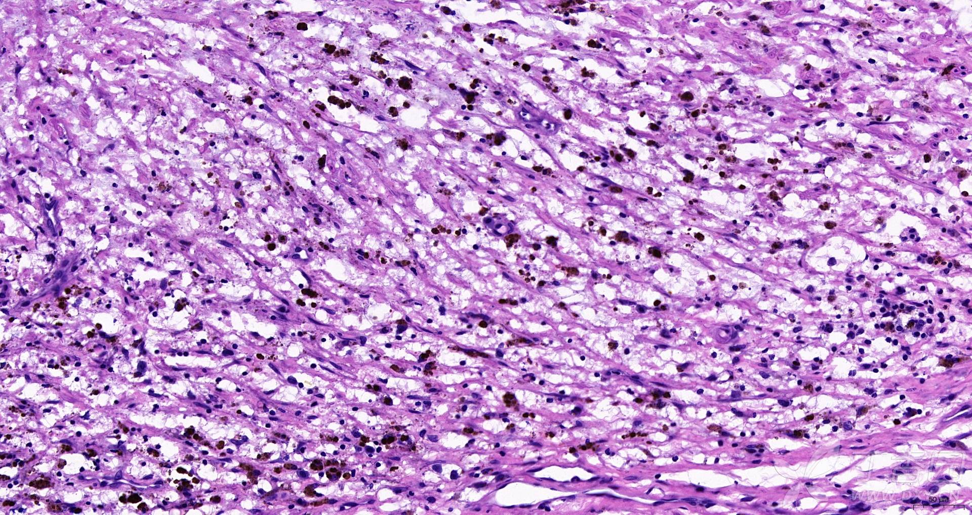 求助:人主动脉he染色切片 谢谢!