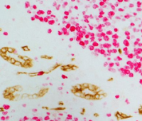 (anti-mouse IgG-brown, anti-rabbit IgG-red)免疫组化双染试剂盒(HRP/AP双染)