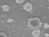 NK-92MI(人恶性非霍奇金淋巴瘤患者的自然杀伤细胞) 带证书