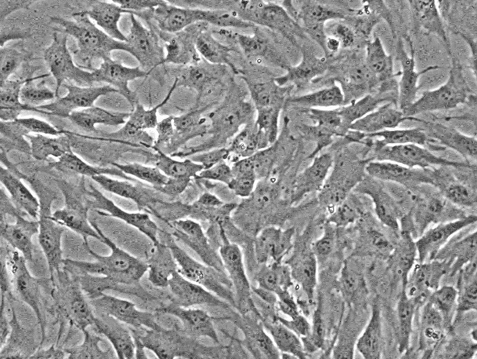 HCC 94 [HCC941122](人子宫鳞癌细胞（高分化）)通过STR鉴定