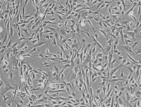 PLC/PRF/5(人肝癌亚力山大细胞)通过STR鉴定