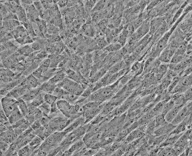 SiHa（人子宫颈鳞癌细胞）(通过STR鉴定)