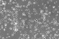 MDA-MB-468(人乳腺癌细胞)通过STR鉴定