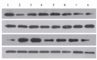 Western blot