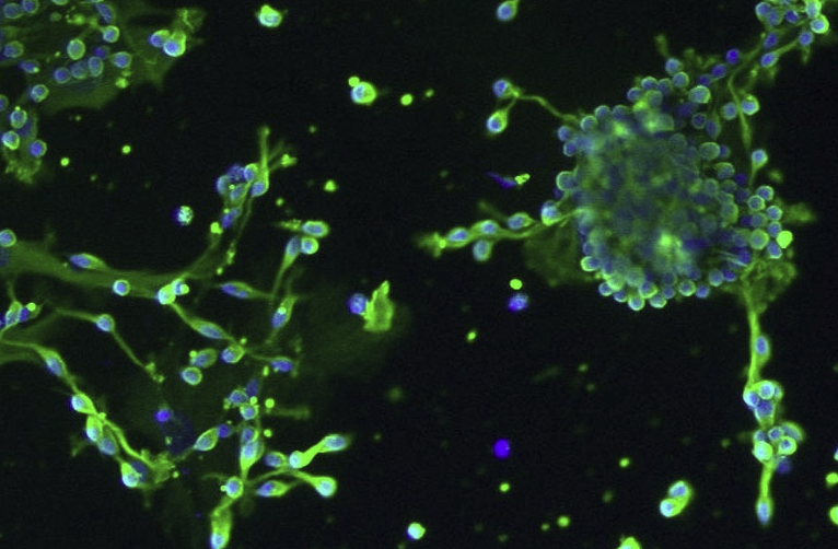 NCI-H661(人大细胞肺癌细胞)通过STR鉴定