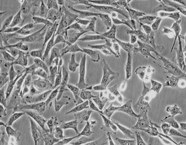 CCD-1095Sk(人乳腺浸润性导管癌旁皮肤细胞)