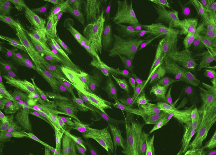 KG-1(人急性骨髓性白血病细胞)通过STR鉴定