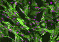 KG-1(人急性骨髓性白血病细胞)通过STR鉴定
