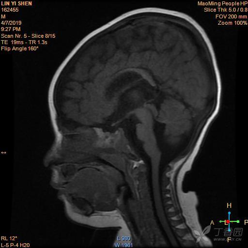 3342265967652190052-8w.jpg