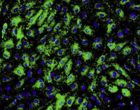 Beta-TC-6(小鼠胰腺癌beta细胞)