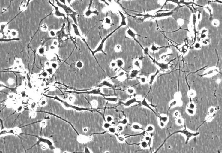 PC-12（大鼠肾上腺嗜铬细胞瘤） 