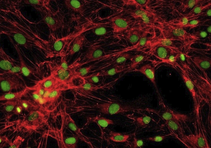 PT67(小鼠逆转录病毒包装细胞)