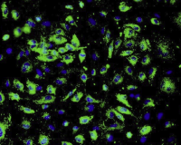 Hs 683（人脑视神经胶质瘤细胞）通过STR鉴定