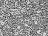 WERI-Rb-1（人视网膜母细胞瘤） 