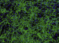 A375人皮肤黑色素瘤细胞通过STR鉴定