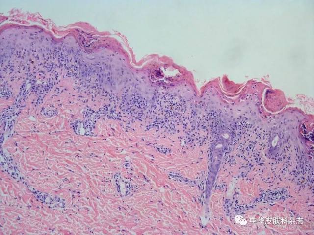 3342569795785886963-8w.jpg!w640