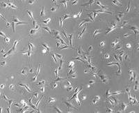 MOLT-4人淋巴细胞白血病细胞(通过STR鉴定)