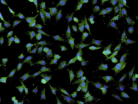 CaLu-3人肺腺癌细胞通过STR鉴定