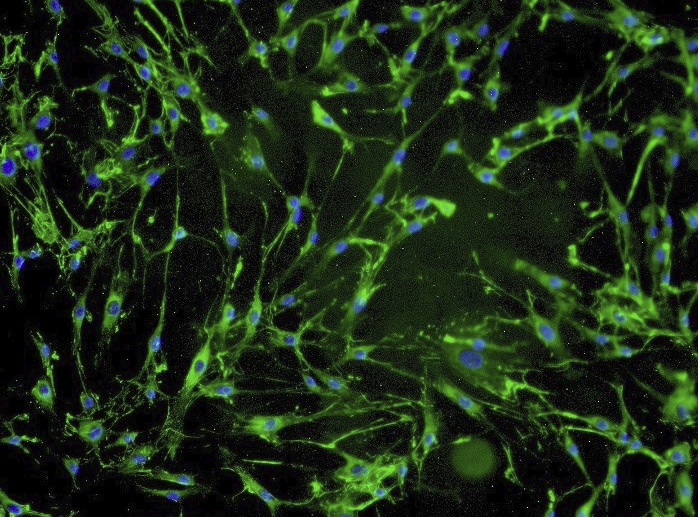 Sars蛋白表达株293001A