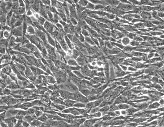 SK-OV-3人卵巢腺瘤细胞(通过STR鉴定)