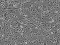 SMMC-7721人肝癌细胞