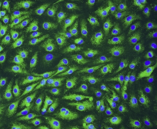 CCC-HB-2人胚胎膀胱组织来源细胞