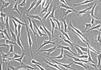 Hep3B人肝癌细胞(通过STR鉴定)
