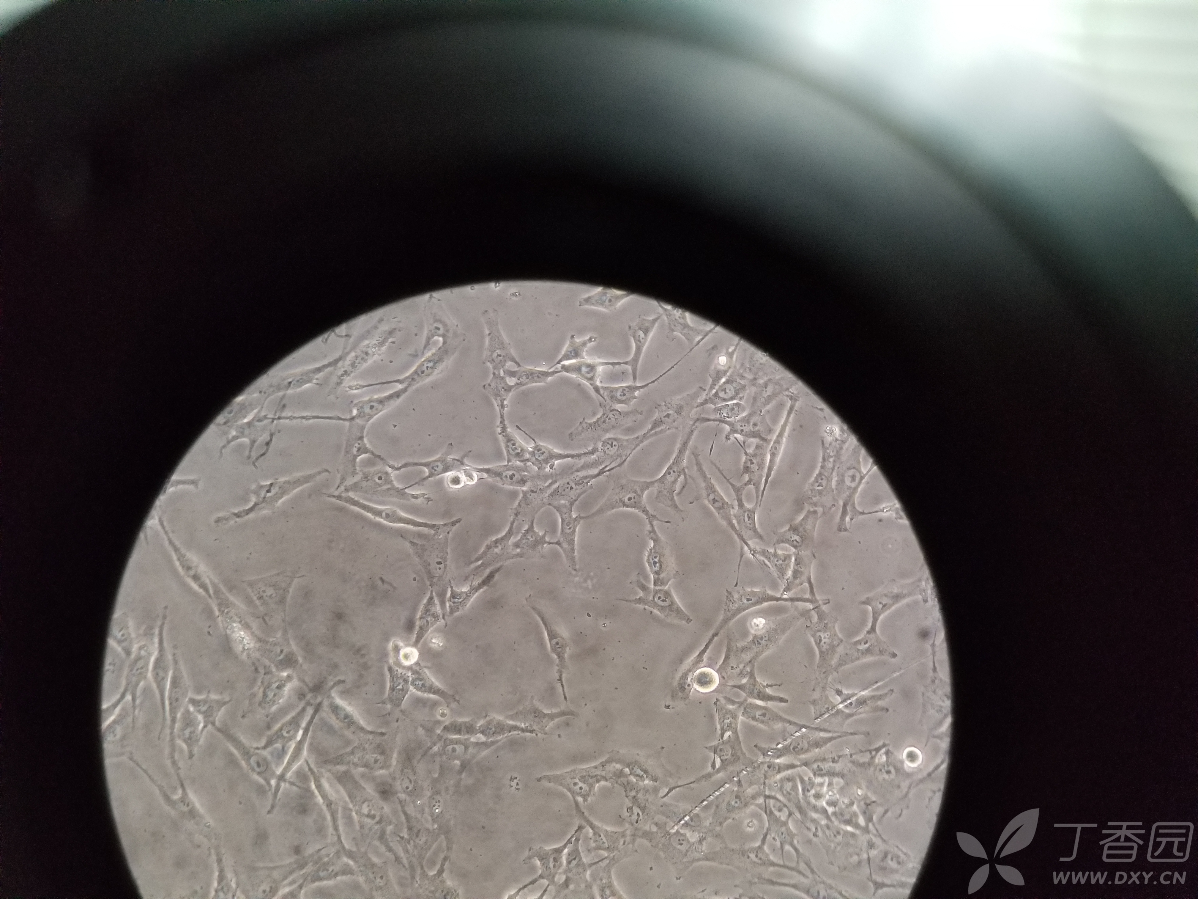 细胞是不是支原体污染?紧急求助!