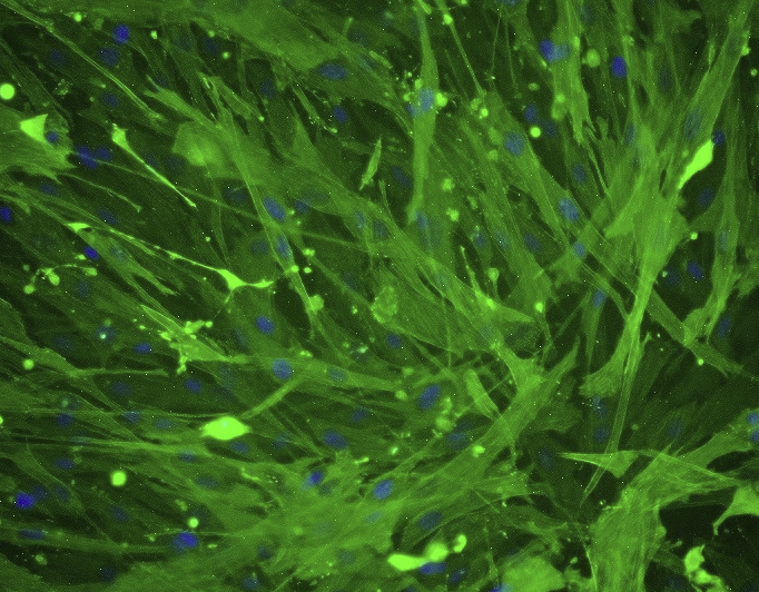 Calu-3人肺腺癌细胞(通过STR鉴定)