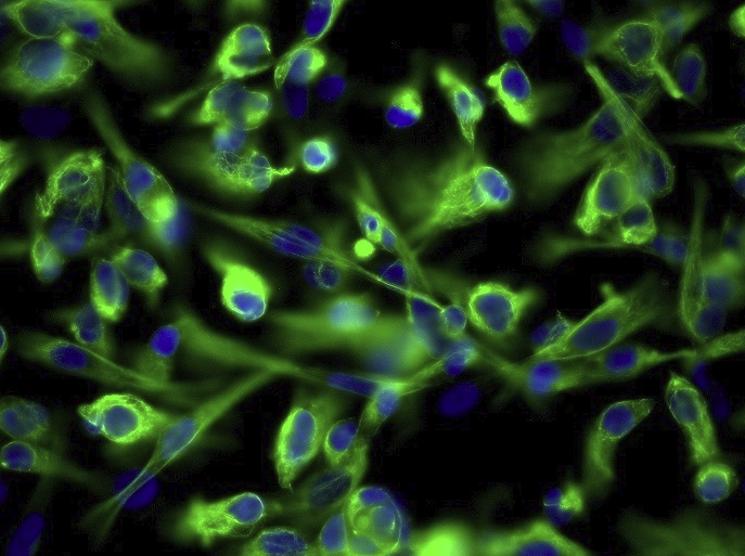 Ec109人食管癌细胞(通过STR鉴定)