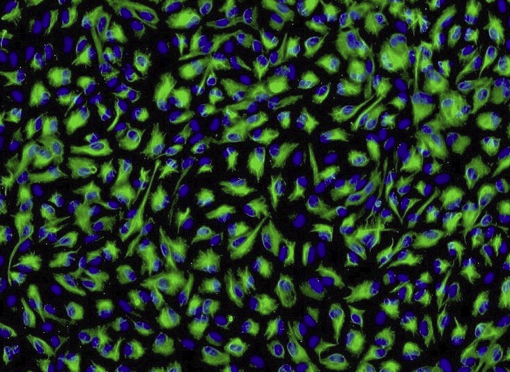 Tsu-Pr1非雄激素依赖型前列腺癌细胞