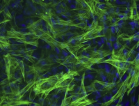 SK-OV-3卵巢癌细胞(通过STR鉴定)