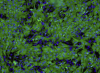 SK-BR-3人乳腺腺癌细胞(通过STR鉴定)