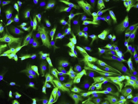 CoC1（人卵巢癌细胞）(通过STR鉴定)