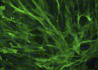 MG-63人成骨肉瘤细胞(通过STR鉴定)