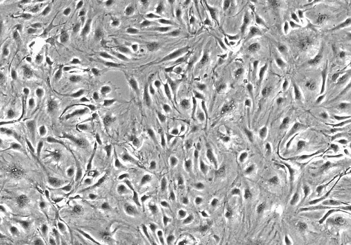 Yac-1小鼠淋巴瘤细胞