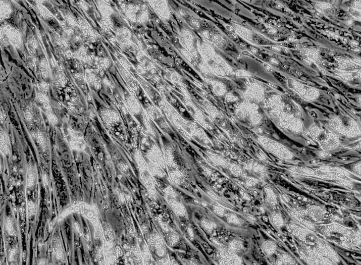 Lovo人结肠癌细胞(通过STR鉴定)