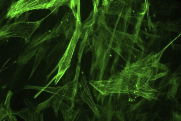 RAW264.7小鼠单核巨噬细胞白血病细胞
