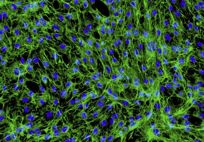 DU-145前列腺癌细胞(通过STR鉴定)