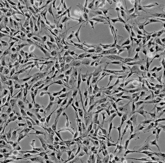 HEPA1-6小鼠肝癌细胞