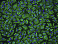 A-204人横纹肌肉瘤细胞
