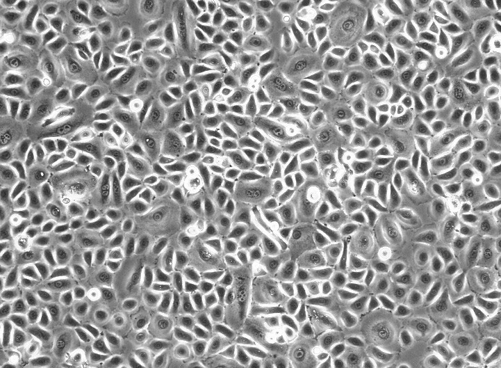EBV转化的绒猴白细胞B95-8