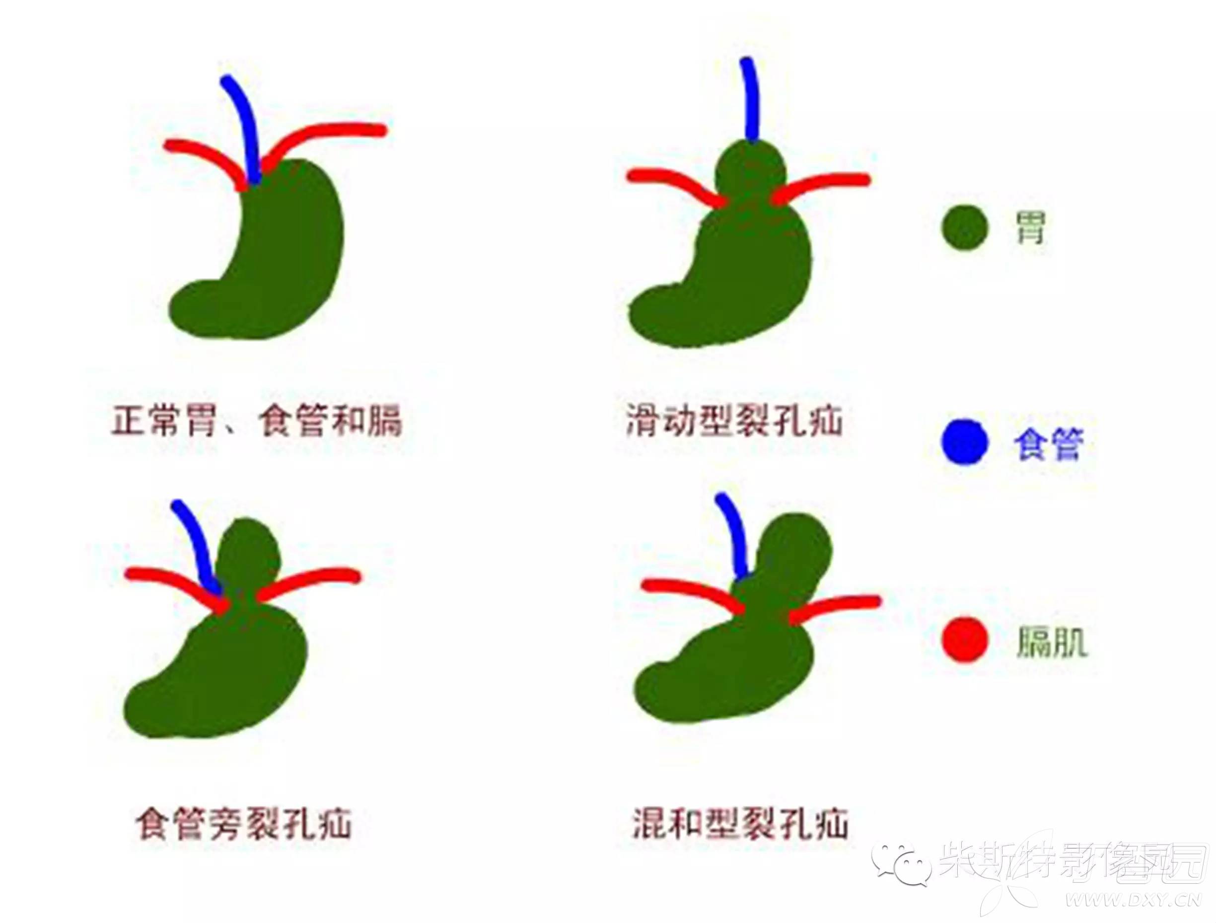 论坛