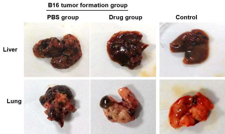 黑色素肿瘤移植(TT)小鼠模型构建